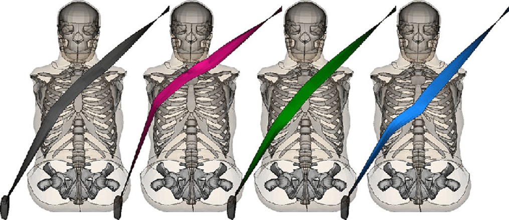 Welcome to Karl-Johan Larsson's Doctoral Thesis defence: 